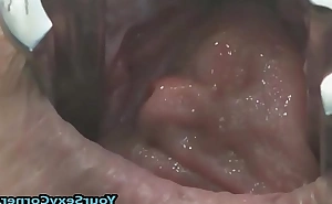 Original anal with the addition of bawdy cleft prolapse after unnatural dp