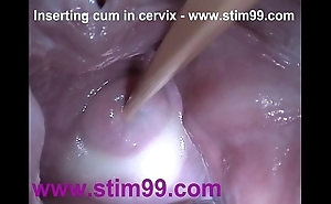 Insertion goo cum anent cervix in flourishing bawdy cleft reflector
