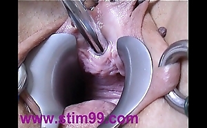 Peehole dissimulate making out urethral prudent insertion dilation